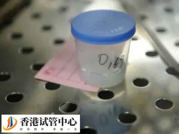 供精后代不是自己的要理解和接受血缘关系