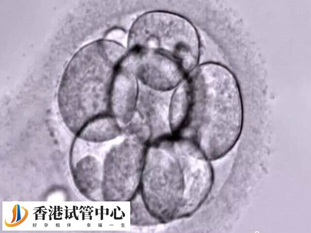卵泡质量是决定受精成败的关键因素