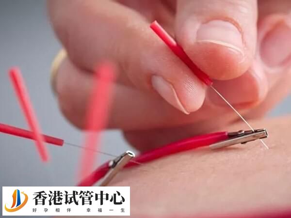 试管促排卵做电针的效果因人而异