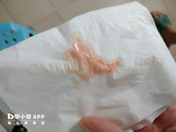 子宫出血是排卵障碍的症状之一