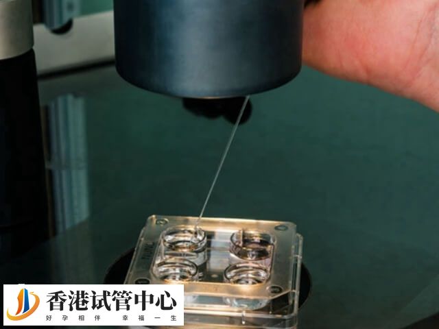 多个精子进入卵母细胞的原因比较多